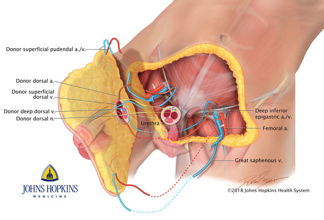 Fișier:Penetration of the penis into the terasaandreea.ro - Wikipedia