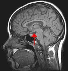 the-hypothalamus-a-small-brain-region-near-the-base-of-the-spinal-cord-plays-a-big-role-in-hormone