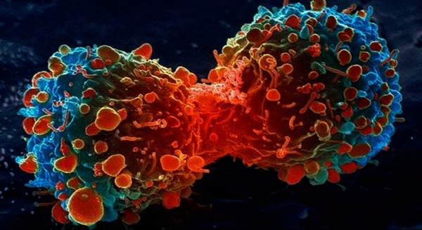 Türk araştırmacıdan kanserle mücadelede büyük keşif!