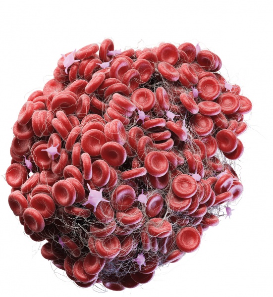 COVID-19 KAN PIHTILAŞTIRICI HÜCRELERDE YÜKSEK AKTİVİTEYE YOL AÇIYOR