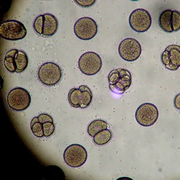 Balanslama Tekniği İle Bebek Özlemine Son