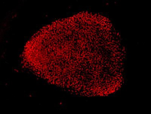 CRISPR Gen Terapisi ile Körlüğe Neden Olan Gen Onarıldı