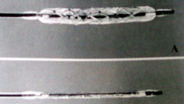 Çin'in geliştirdiği yeni kalp stenti dünya çapında büyük kabul gördü