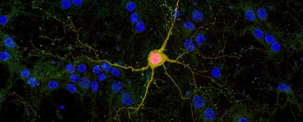 Zarar görmüş beyinlere sağlıklı sinir hücreleri enjekte edilmesinin önü açıldı