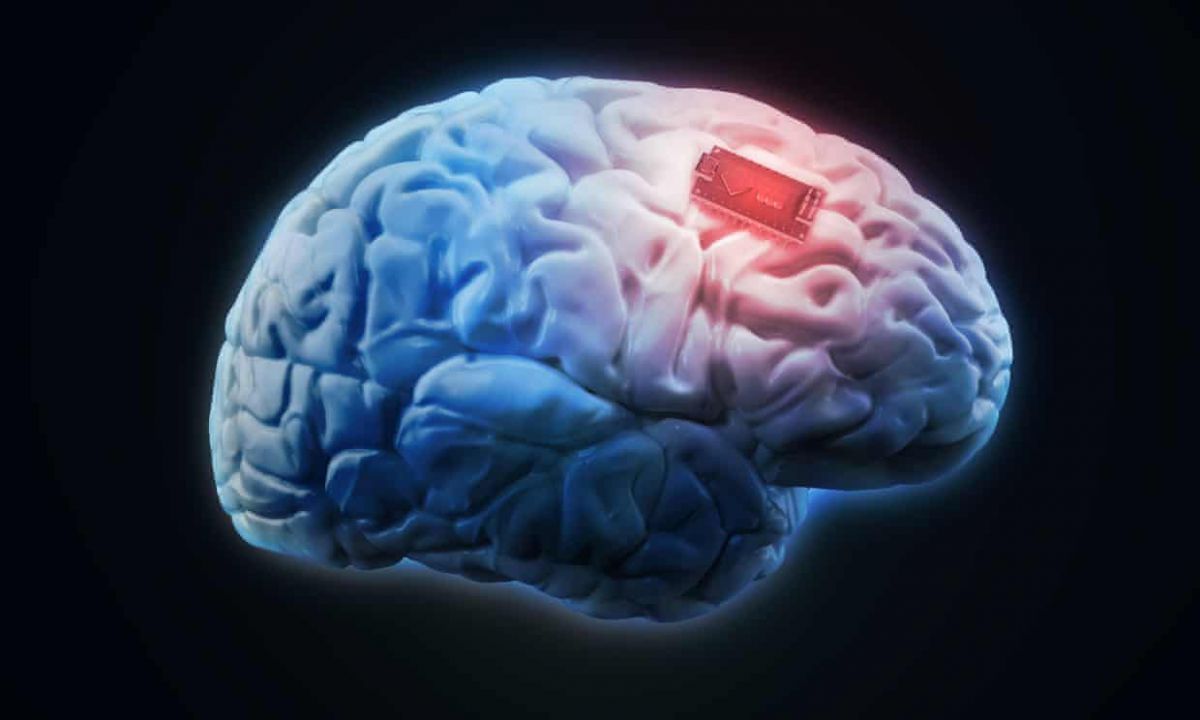 Beyin İmplantı ile Körlüğe Kısmi Çözüm Sağlandı